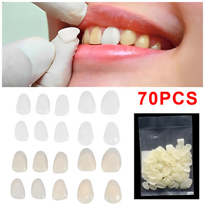 #ad 70x Dental Teeth Veneers Thin Whitening Resin Anterior Upper Temporary Crown US