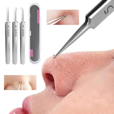 #ad 3PCS Stainless Steel Acne Clip Acne Needle Set Blackhead Needle Clean Cell Clip