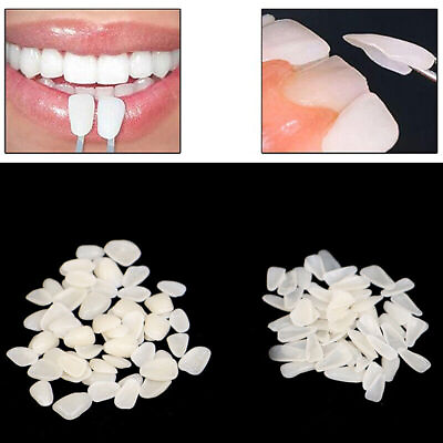 #ad 60Pcs Dental Ultra Thin Whitening Veneers Resin Temporary Teeth Whiten juPTU@H5