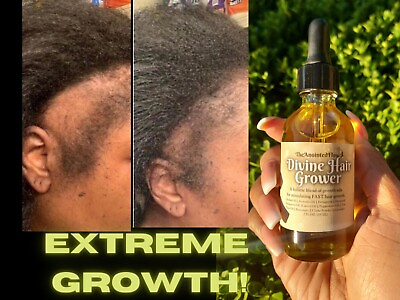 #ad FAST HAIR GROWTH Organic Growth Oil Balding Thin Edges Alopecia Chebe Miracle