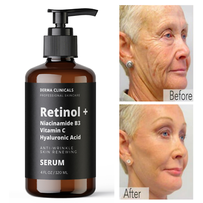 #ad Retinol Niacinamide Vitamin C Hyaluronic Acid AntiAging Wrinkle SERUM 4oz
