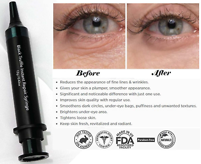 Black Truffle Instant Repair Syringe Instant Puffiness and Wrinkle Reducer 😍